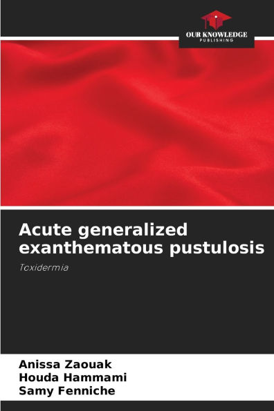 Acute generalized exanthematous pustulosis