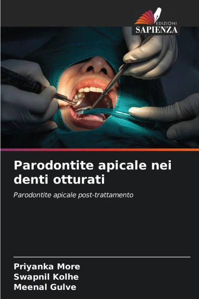 Parodontite apicale nei denti otturati