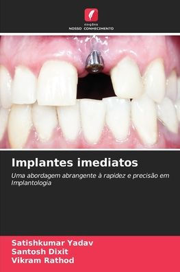 Implantes imediatos