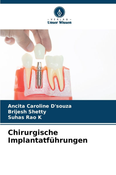 Chirurgische Implantatfï¿½hrungen
