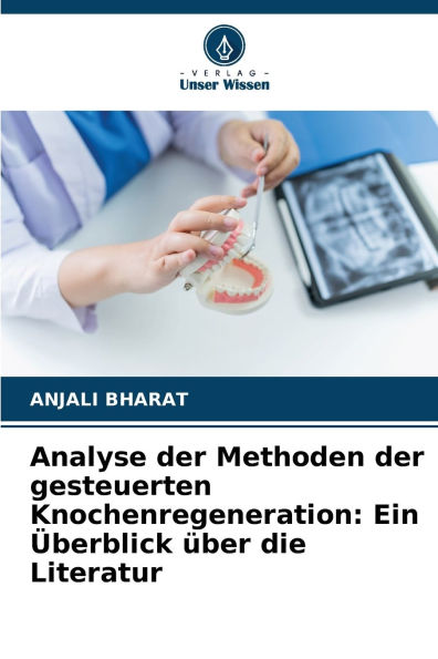 Analyse der Methoden der gesteuerten Knochenregeneration: Ein ï¿½berblick ï¿½ber die Literatur