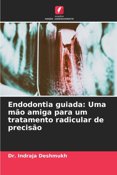 Endodontia guiada: Uma mï¿½o amiga para um tratamento radicular de precisï¿½o