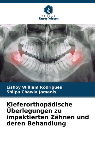 Kieferorthopï¿½dische ï¿½berlegungen zu impaktierten Zï¿½hnen und deren Behandlung