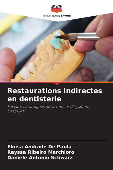 Restaurations indirectes en dentisterie