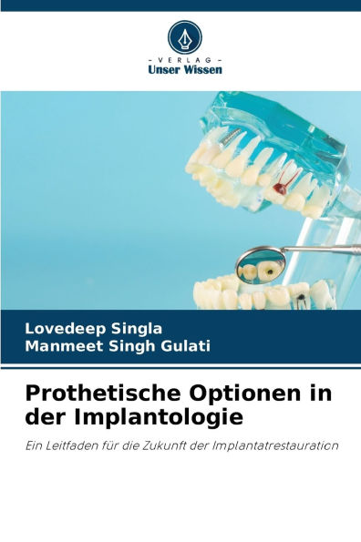 Prothetische Optionen in der Implantologie