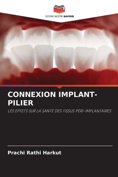 Connexion Implant-Pilier