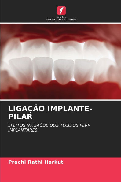 Ligaï¿½ï¿½o Implante-Pilar