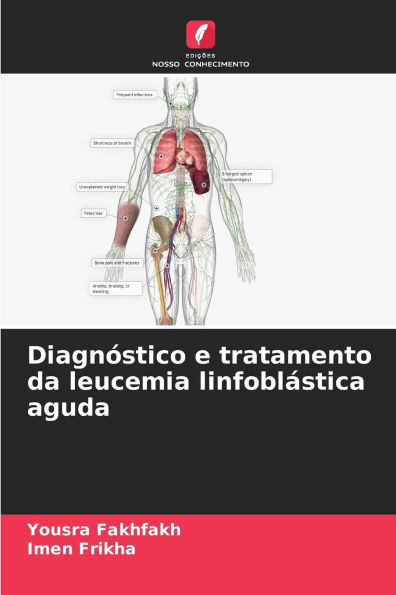 Diagnï¿½stico e tratamento da leucemia linfoblï¿½stica aguda