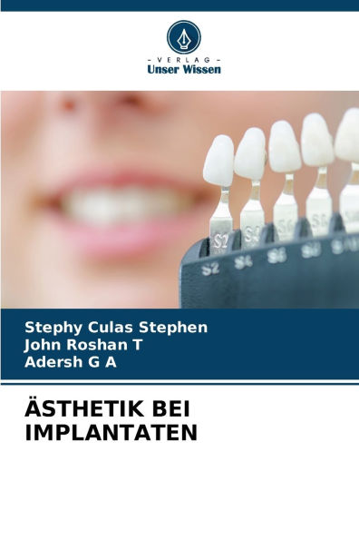 ï¿½sthetik Bei Implantaten