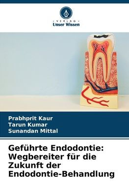 Gefï¿½hrte Endodontie: Wegbereiter fï¿½r die Zukunft der Endodontie-Behandlung