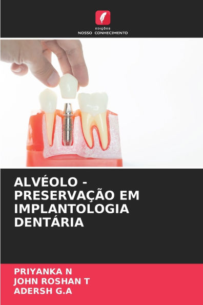 Alvï¿½olo - Preservaï¿½ï¿½o Em Implantologia Dentï¿½ria