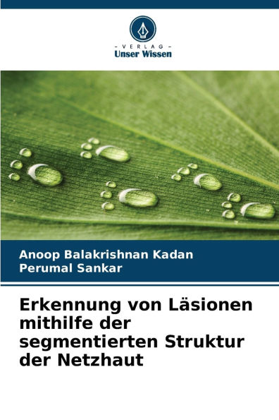 Erkennung von Lï¿½sionen mithilfe der segmentierten Struktur der Netzhaut