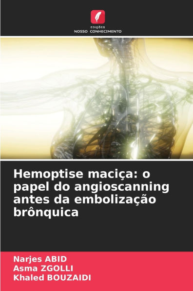 Hemoptise maciï¿½a: o papel do angioscanning antes da embolizaï¿½ï¿½o brï¿½nquica