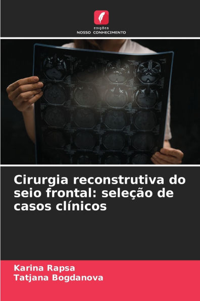 Cirurgia reconstrutiva do seio frontal: seleï¿½ï¿½o de casos clï¿½nicos