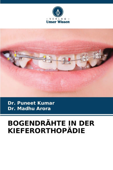 Bogendrï¿½hte in Der Kieferorthopï¿½die