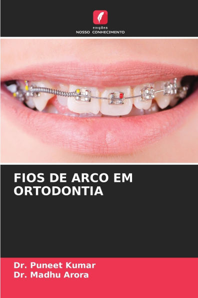 Fios de Arco Em Ortodontia