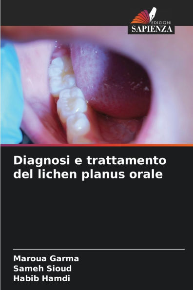 Diagnosi e trattamento del lichen planus orale