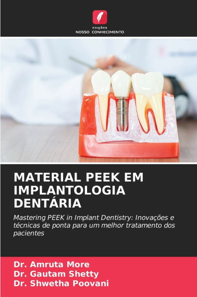 Material Peek Em Implantologia Dentï¿½ria