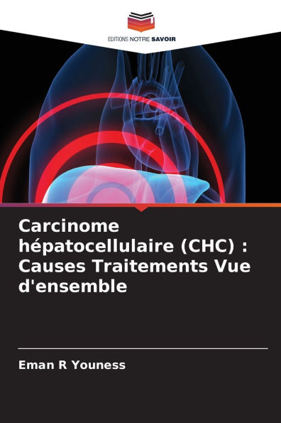Carcinome hï¿½patocellulaire (CHC): Causes Traitements Vue d'ensemble