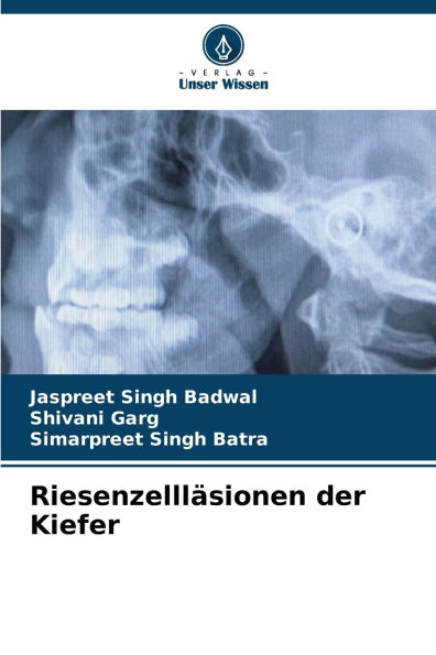 Riesenzelllï¿½sionen der Kiefer