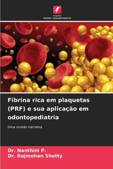 Fibrina rica em plaquetas (PRF) e sua aplicaï¿½ï¿½o em odontopediatria