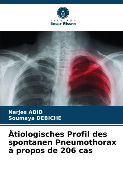 ï¿½tiologisches Profil des spontanen Pneumothorax ï¿½ propos de 206 cas