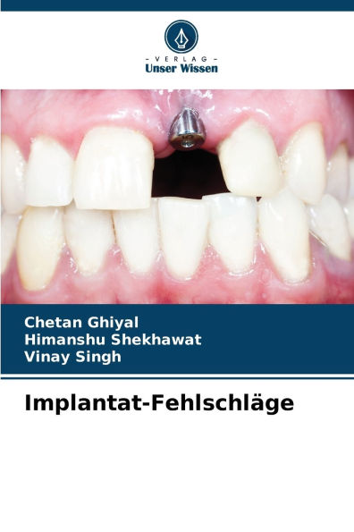 Implantat-Fehlschlï¿½ge