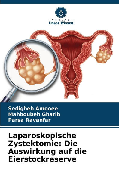 Laparoskopische Zystektomie: Die Auswirkung auf die Eierstockreserve