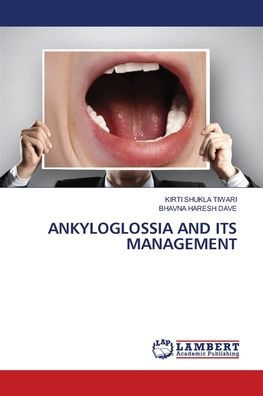 Ankyloglossia and Its Management