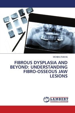 Fibrous Dysplasia and Beyond: Understanding Fibro-Osseous Jaw Lesions