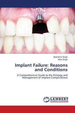 Implant Failure: Reasons and Conditions
