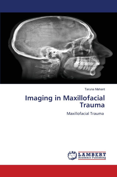 Imaging in Maxillofacial Trauma