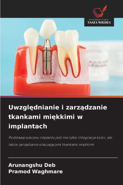 Uwzględnianie i zarządzanie tkankami miękkimi w implantach