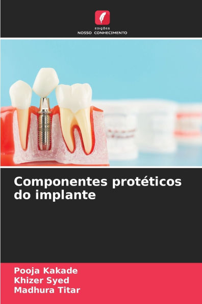 Componentes protï¿½ticos do implante