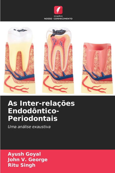 As Inter-relaï¿½ï¿½es Endodï¿½ntico-Periodontais