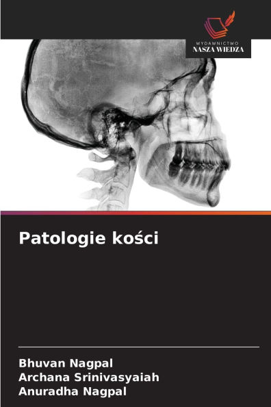 Patologie kości