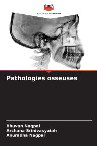 Title: Pathologies osseuses, Author: Bhuvan Nagpal
