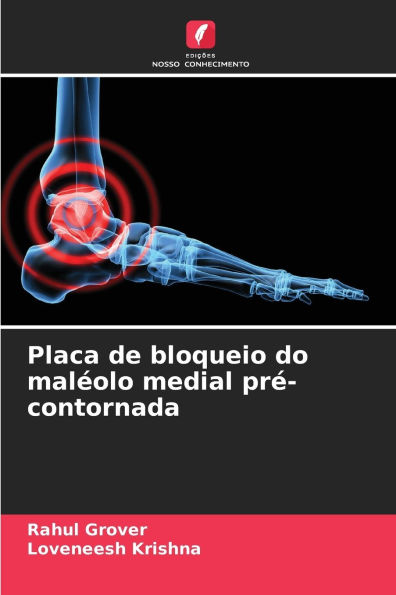Placa de bloqueio do malï¿½olo medial prï¿½-contornada