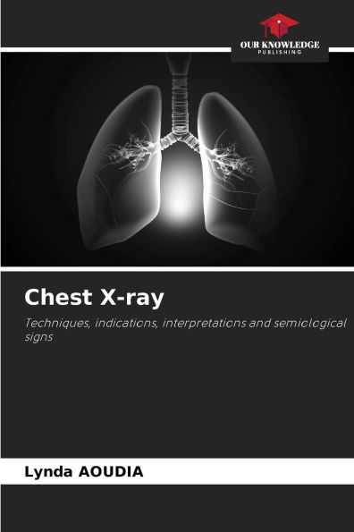 Chest X-ray