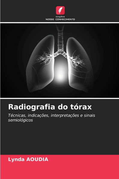 Radiografia do tï¿½rax