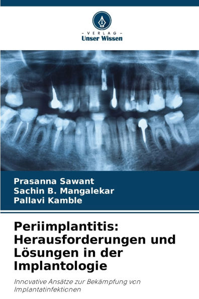 Periimplantitis: Herausforderungen und Lï¿½sungen in der Implantologie