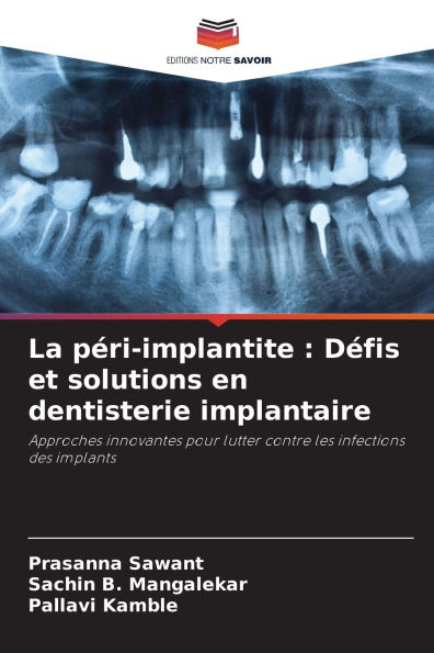 La pï¿½ri-implantite: Dï¿½fis et solutions en dentisterie implantaire