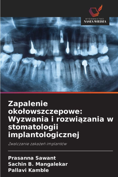 Zapalenie okolowszczepowe: Wyzwania i rozwiązania w stomatologii implantologicznej