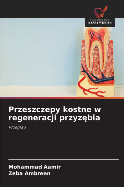 Przeszczepy kostne w regeneracji przyzębia