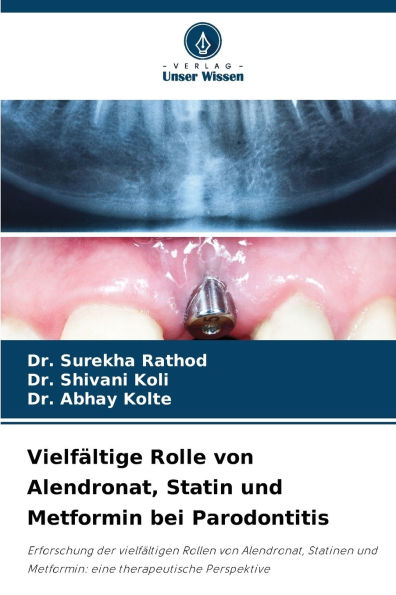 VielfÃ¯Â¿Â½ltige Rolle von Alendronat, Statin und Metformin bei Parodontitis