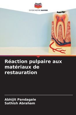 RÃ¯Â¿Â½action pulpaire aux matÃ¯Â¿Â½riaux de restauration