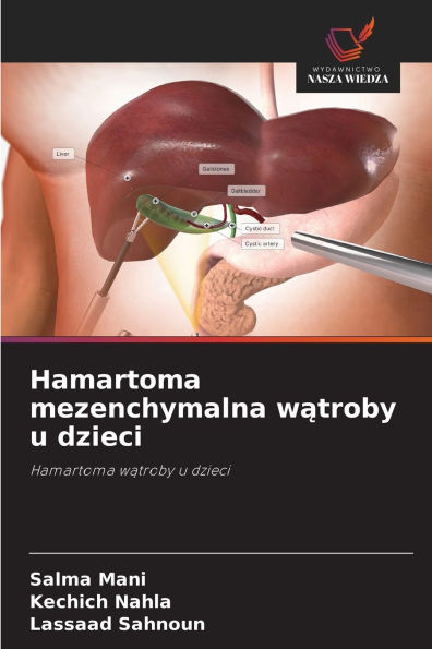 Hamartoma mezenchymalna wątroby u dzieci
