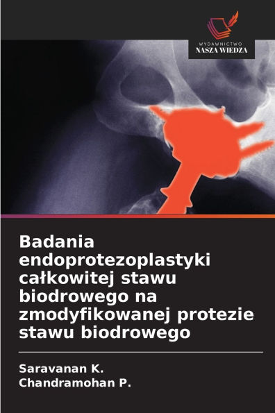 Badania endoprotezoplastyki calkowitej stawu biodrowego na zmodyfikowanej protezie stawu biodrowego