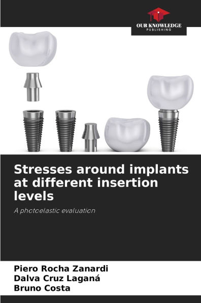 Stresses around implants at different insertion levels