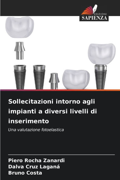 Sollecitazioni intorno agli impianti a diversi livelli di inserimento